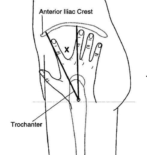 肌内注射视频,肌内注射操作步骤详解与视频教程